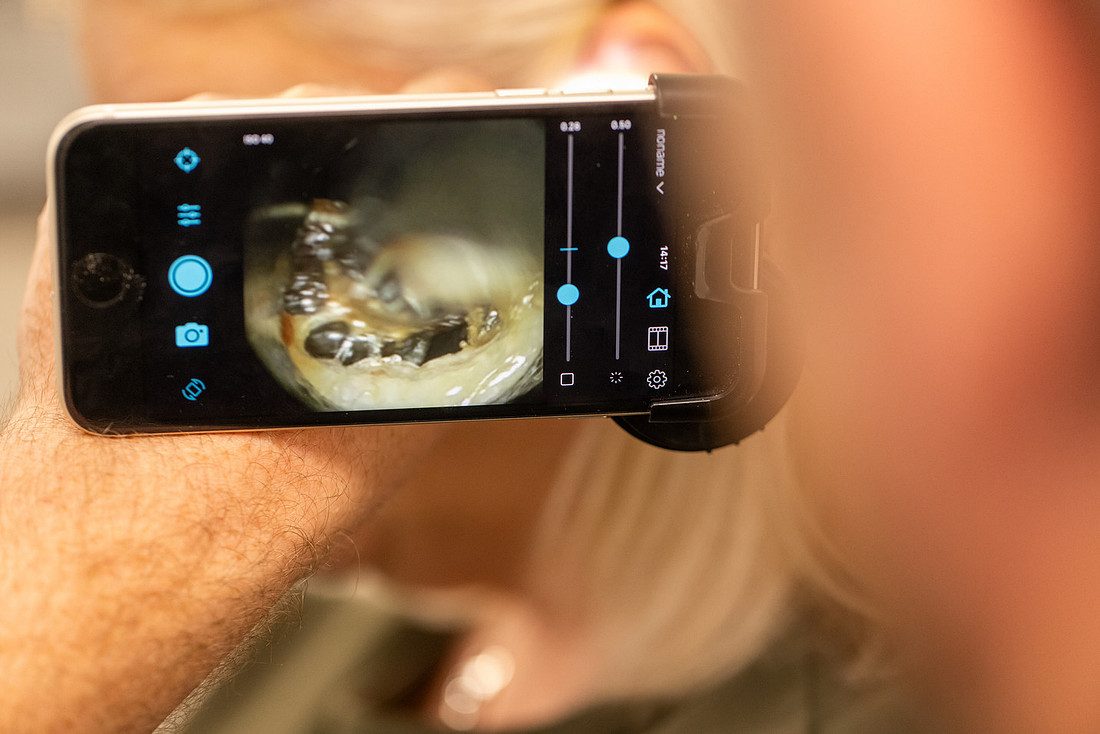 Live view of a patient's ear canal on a video otoscope screen